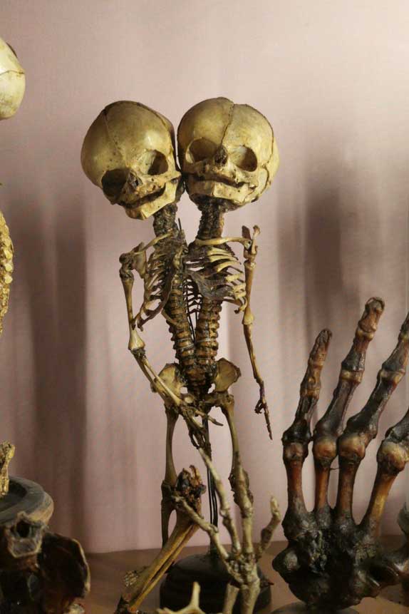 weird-two-headed-skeleton